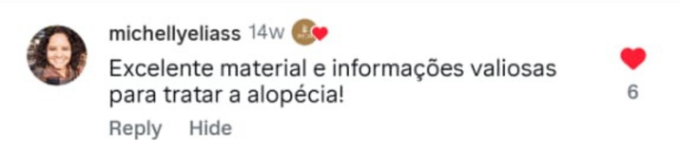Depoimento real de leitora com alopecia ou eflúvio